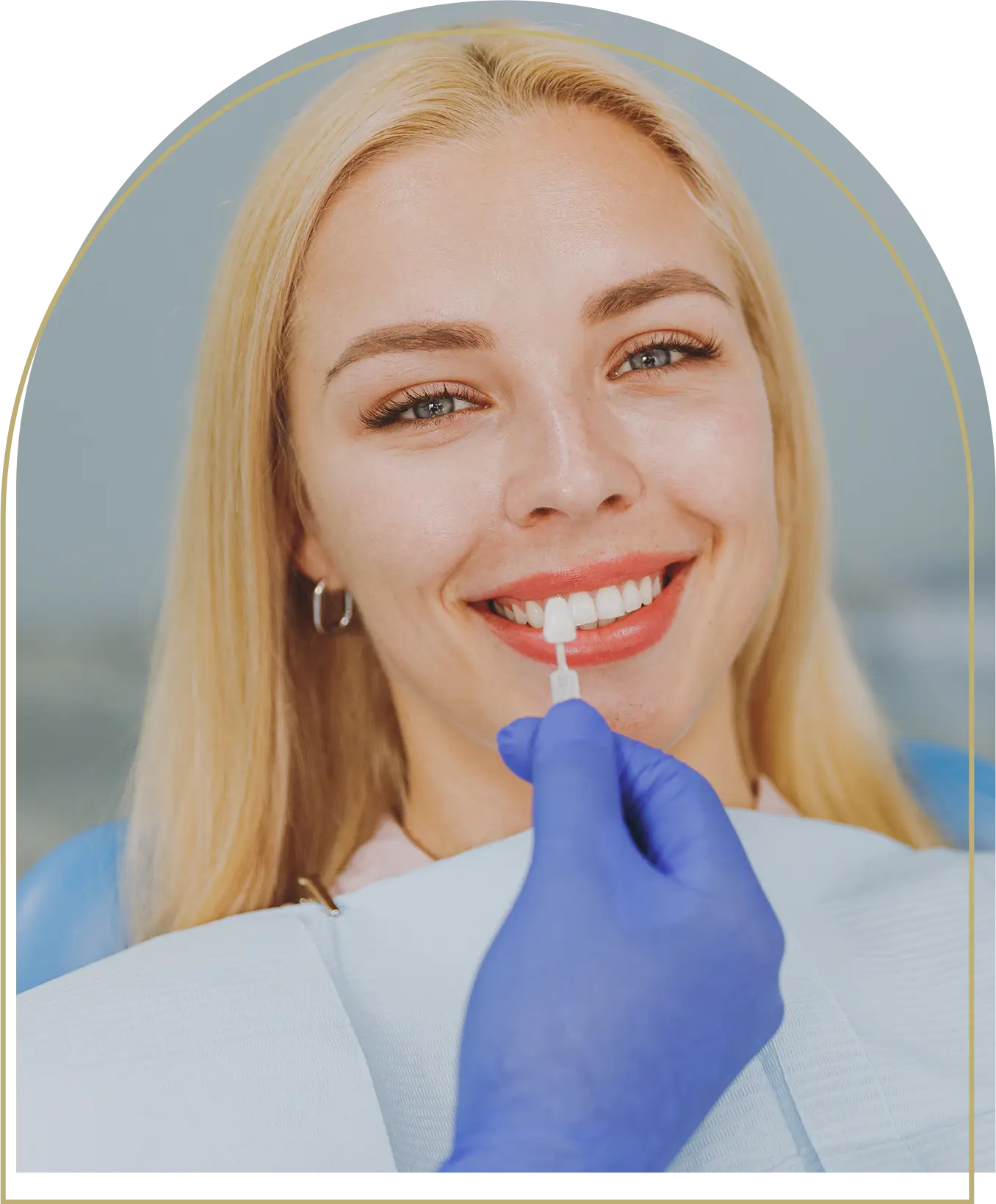 Porcelain Veneers Dubbo Dentist