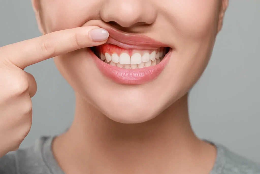 gum disease treatment