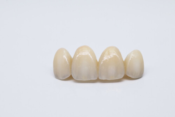 tooth filling cost cavities