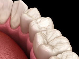 How Long Does a Tooth Filling Last after