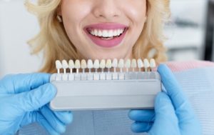 Does Teeth Whitening Damage Teeth results