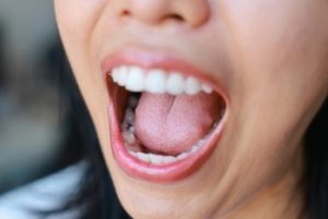 Can-You-Whiten-Composite-Bonding-results