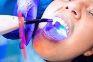 What Is Surgical Tooth Extraction check