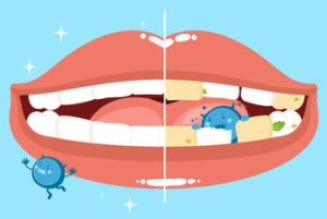 Can Wisdom Teeth Cause Ear and Throat Pain decay
