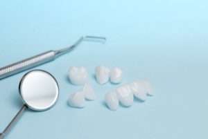 Dental Bonding Procedure veneers