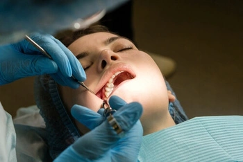 How to Improve Oral Hygiene check
