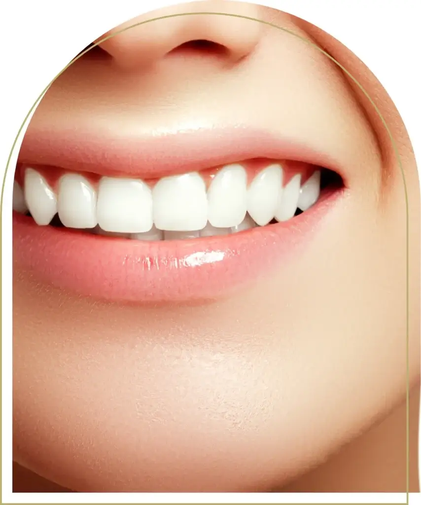 Can you get composite bonding on crooked teeth explained at Advance Dental Care Dubbo