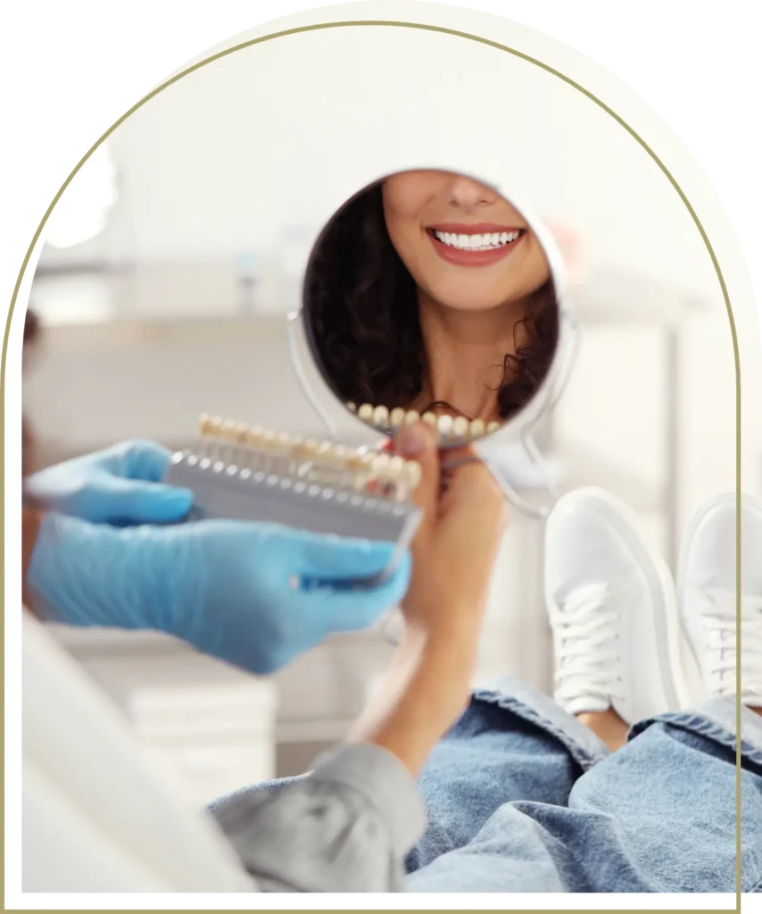 Smile enhancement results after cosmetic dental bonding treatment