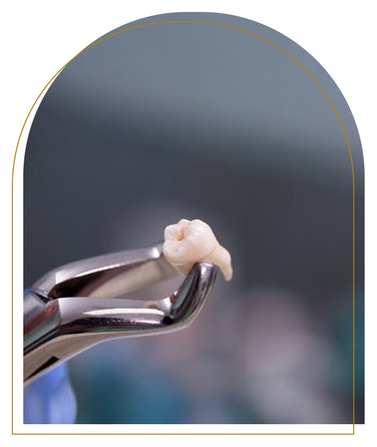 Wisdom tooth removal procedure by dentist in Dubbo at Advanced Dental Care.