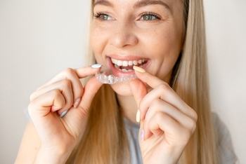 Close-up of straight teeth after Invisalign and composite bonding transformation.