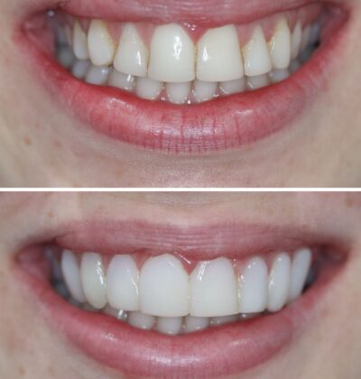 ADC Dubbo Dentist team providing gentle dental care in a modern clinic setting